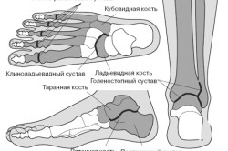 Bol u metatarzalnoj kosti stopala